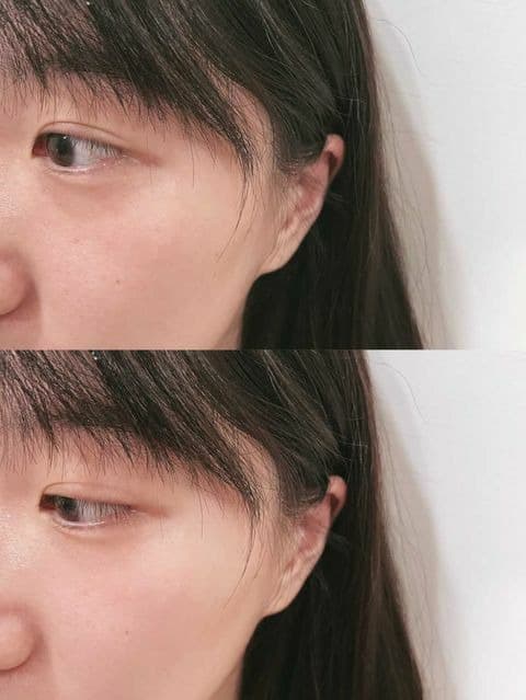 焄焄焄｜皮秒雷射後推薦 圖片